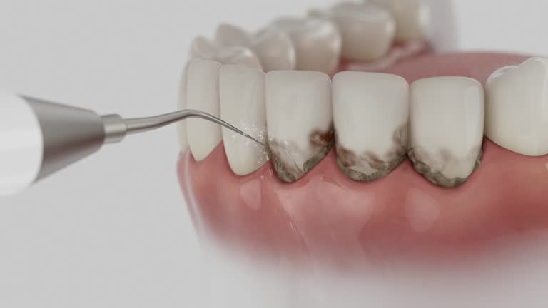 Trusted Teeth Cleaning And Checkup service in Gonzales, TX - Dentist Open Now